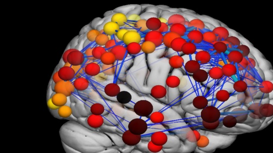 Scans reveal how teenage brain develops
